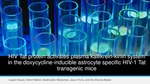 R03. HIV Tat protein activates plasma kallikrein-kinin system in the doxycycline-inducible astrocyte specific HIV-1 Tat transgenic mice by Logan Sneed, Fakhri Mahdi, Salahoddin Mohamed, Jason J. Paris, and Zia Shariat-Madar